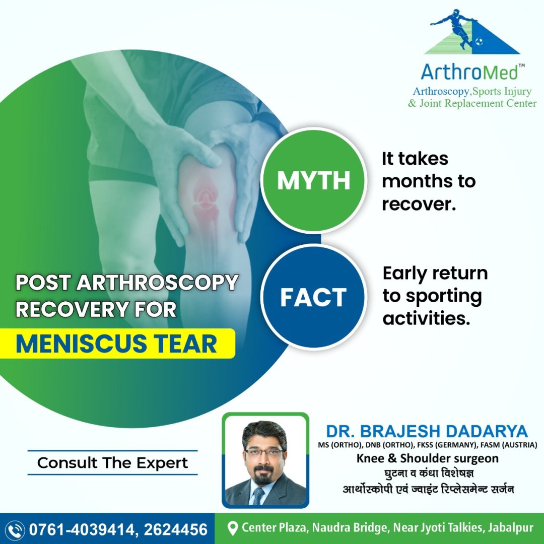 myth about meniscus tear